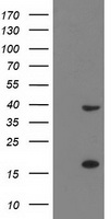 PDLIM2 / SLIM Antibody - HEK293T cells were transfected with the pCMV6-ENTRY control (Left lane) or pCMV6-ENTRY PDLIM2 (Right lane) cDNA for 48 hrs and lysed. Equivalent amounts of cell lysates (5 ug per lane) were separated by SDS-PAGE and immunoblotted with anti-PDLIM2.