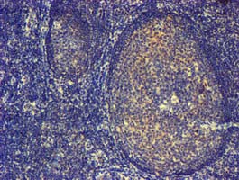 PDLIM2 / SLIM Antibody - IHC of paraffin-embedded Human tonsil using anti-PDLIM2 mouse monoclonal antibody.