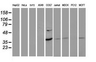 PDLIM2 / SLIM Antibody - Western blot of extracts (35 ug) from 9 different cell lines by using anti-PDLIM2 monoclonal antibody.