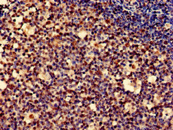 PDLIM2 / SLIM Antibody - Immunohistochemistry of paraffin-embedded human tonsil tissue at dilution of 1:100