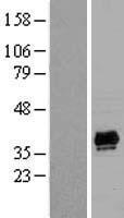 PDLIM2 / SLIM Protein - Western validation with an anti-DDK antibody * L: Control HEK293 lysate R: Over-expression lysate