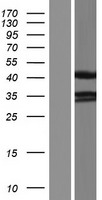 PDLIM2 / SLIM Protein - Western validation with an anti-DDK antibody * L: Control HEK293 lysate R: Over-expression lysate