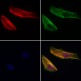 PDLIM3 Antibody - Staining HeLa cells by IF/ICC. The samples were fixed with PFA and permeabilized in 0.1% Triton X-100, then blocked in 10% serum for 45 min at 25°C. Samples were then incubated with primary Ab(1:200) and mouse anti-beta tubulin Ab(1:200) for 1 hour at 37°C. An AlexaFluor594 conjugated goat anti-rabbit IgG(H+L) Ab(1:200 Red) and an AlexaFluor488 conjugated goat anti-mouse IgG(H+L) Ab(1:600 Green) were used as the secondary antibod