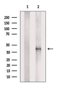 PDLIM3 Antibody