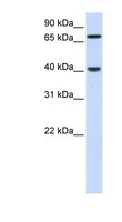 PDLIM3 Antibody - PDLIM3 antibody Western blot of Fetal Liver lysate. This image was taken for the unconjugated form of this product. Other forms have not been tested.