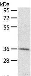 PDLIM4 / RIL Antibody - Western blot analysis of A431 cell, using PDLIM4 Polyclonal Antibody at dilution of 1:400.