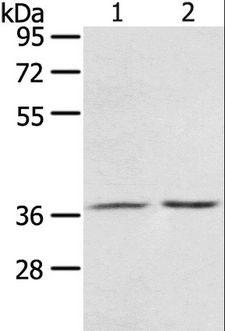 PDLIM4 / RIL Antibody - Western blot analysis of Mouse stomach tissue and A431 cell, using PDLIM4 Polyclonal Antibody at dilution of 1:800.