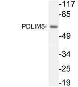 PDLIM5 / LIM Antibody - Western blot analysis of lysate from A549 cells, using PDLIM5 antibody.