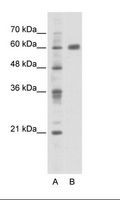 PDLIM5 / LIM Antibody - A: Marker, B: HepG2 Cell Lysate.  This image was taken for the unconjugated form of this product. Other forms have not been tested.