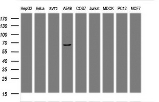 PDLIM5 / LIM Antibody - Western blot of extracts (35 ug) from 9 different cell lines by using anti-${SYMBOL} monoclonal antibody (HepG2: human; HeLa: human; SVT2: mouse; A549: human; COS7: monkey; Jurkat: human; MDCK: canine; PC12: rat; MCF7: human).