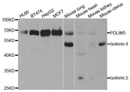 PDLIM5 / LIM Antibody - Western blot analysis of extracts of various cell lines, using PDLIM5 antibody.