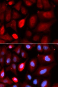 PDLIM5 / LIM Antibody - Immunofluorescence analysis of U20S cell using PDLIM5 antibody. Blue: DAPI for nuclear staining.