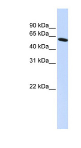 PDLIM5 / LIM Antibody - PDLIM5 antibody Western blot of HepG2 cell lysate. This image was taken for the unconjugated form of this product. Other forms have not been tested.