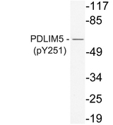PDLIM5 / LIM Antibody - Western blot analysis of lysate from K562 cells, uisng phospho-PDLIM5 (Phospho-Tyr251) antibody.