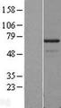 PDLIM5 / LIM Protein - Western validation with an anti-DDK antibody * L: Control HEK293 lysate R: Over-expression lysate