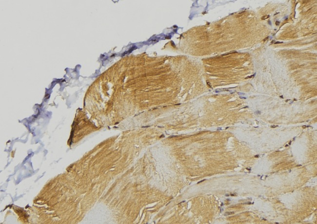 PDLIM7 / Enigma Antibody - 1:100 staining mouse muscle tissue by IHC-P. The sample was formaldehyde fixed and a heat mediated antigen retrieval step in citrate buffer was performed. The sample was then blocked and incubated with the antibody for 1.5 hours at 22°C. An HRP conjugated goat anti-rabbit antibody was used as the secondary.