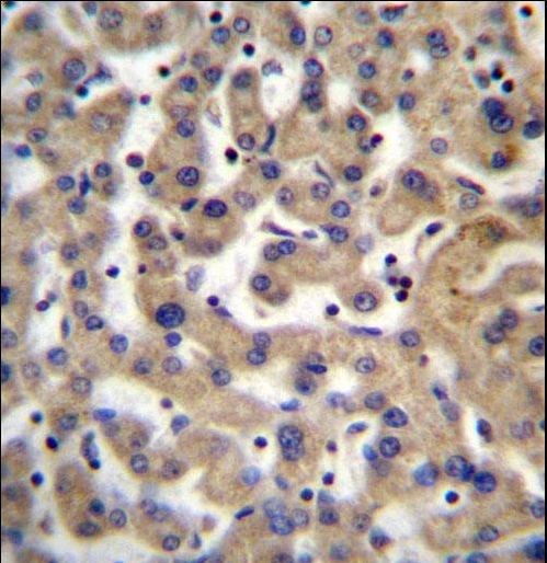 PDP1 Antibody - PDP1 Antibody immunohistochemistry of formalin-fixed and paraffin-embedded human liver tissue followed by peroxidase-conjugated secondary antibody and DAB staining.