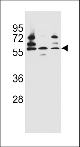 PDP1 Antibody - PDP1 Antibody western blot of Jurkat,HepG2,293 cell line lysates (35 ug/lane). The PDP1 antibody detected the PDP1 protein (arrow).