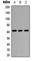 PDP1 Antibody - Western blot analysis of PDP1 expression in A549 (A); NS-1 (B); MCF7 (C) whole cell lysates.