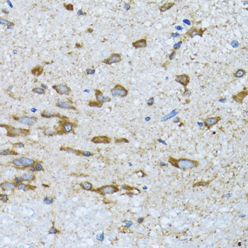 PDP1 Antibody - Immunohistochemistry of paraffin-embedded mouse spinal cord tissue.