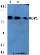 PDP1 Antibody - Western blot of PDP1 antibody at 1:500 dilution. Lane 1: A549 whole cell lysate. Lane 2: sp2/0 whole cell lysate. Lane 3: MCF-7 whole cell lysate.