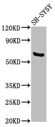 PDP1 Antibody - Positive Western Blot detected in SH-SY5Y whole cell lysate. All lanes: PDP1 antibody at 3.6 µg/ml Secondary Goat polyclonal to rabbit IgG at 1/50000 dilution. Predicted band size: 62, 64 KDa. Observed band size: 62 KDa
