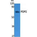 PDP2 Antibody - Western blot of PDP2 antibody
