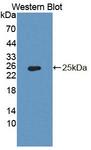 PDP2 Antibody - Western Blot; Sample: Recombinant protein.