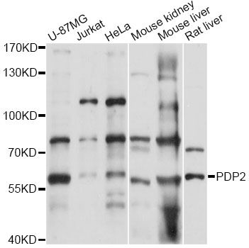 PDP2 Antibody - Western blot analysis of extracts of various cell lines, using PDP2 antibody at 1:3000 dilution. The secondary antibody used was an HRP Goat Anti-Rabbit IgG (H+L) at 1:10000 dilution. Lysates were loaded 25ug per lane and 3% nonfat dry milk in TBST was used for blocking. An ECL Kit was used for detection and the exposure time was 15s.