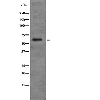 PDP2 Antibody - Western blot analysis of PDP2 expression in Jurkat cells lysate. The lane on the left is treated with the antigen-specific peptide.