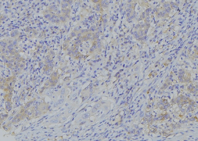 PDP2 Antibody - 1:100 staining human gastric tissue by IHC-P. The sample was formaldehyde fixed and a heat mediated antigen retrieval step in citrate buffer was performed. The sample was then blocked and incubated with the antibody for 1.5 hours at 22°C. An HRP conjugated goat anti-rabbit antibody was used as the secondary.