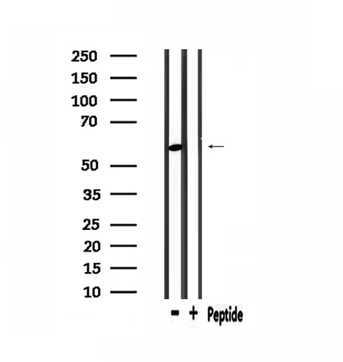 PDP2 Antibody - Western blot analysis of extracts of mouse brain tissue using PDP2 antibody.