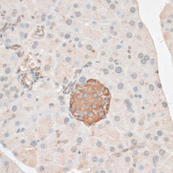 PDP2 Antibody - Immunohistochemistry of paraffin-embedded Mouse pancreas using PDP2 Polyclonal Antibody at dilution of 1:100 (40x lens).