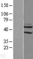 PDP2 Protein - Western validation with an anti-DDK antibody * L: Control HEK293 lysate R: Over-expression lysate