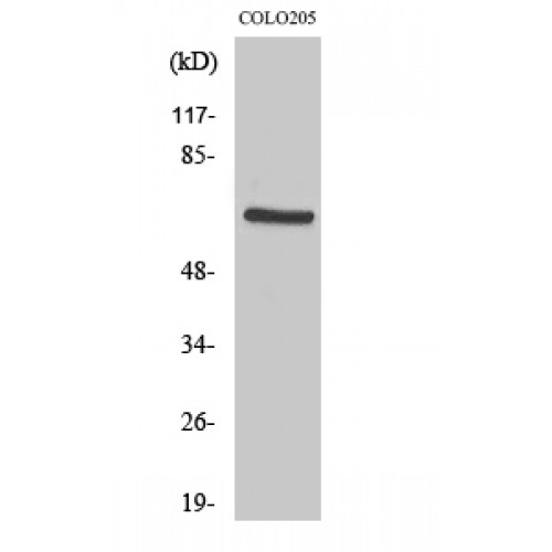 PDPK1 / PDK1 Antibody - Western blot of PDK1 antibody