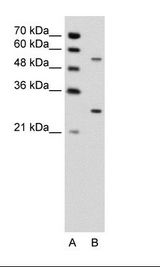 PDPK1 / PDK1 Antibody - A: Marker, B: Jurkat Cell Lysate.  This image was taken for the unconjugated form of this product. Other forms have not been tested.