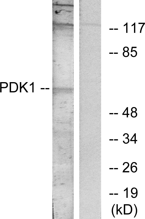 PDPK1 / PDK1 Antibody - Western blot analysis of lysates from MDA-MB-435 cells, treated with EGF, using PDK1 Antibody. The lane on the right is blocked with the synthesized peptide.