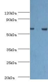 PDPK1 / PDK1 Antibody - Western blot. All lanes: 3-phosphoinositide-dependent protein kinase 1 antibody at 2.5 ug/ml. Lane 1: HeLa whole cell lysate. Lane 2: A549 whole cell lysate. secondary Goat polyclonal to rabbit at 1:10000 dilution. Predicted band size: 63 kDa. Observed band size: 63 kDa.