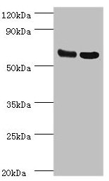 PDPK1 / PDK1 Antibody - Western blot All lanes: PDPK1 antibody at 2.5µg/ml Lane 1: Hela whole cell lysate Lane 2: A549 whole cell lysate Secondary Goat polyclonal to rabbit IgG at 1/10000 dilution Predicted band size: 64, 59, 61, 49, 51 kDa Observed band size: 64 kDa