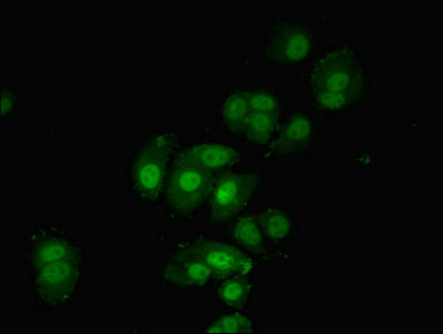 PDPK1 / PDK1 Antibody - Immunofluorescent analysis of MCF-7 cells using PDPK1 Antibody at dilution of 1:100 and Alexa Fluor 488-congugated AffiniPure Goat Anti-Rabbit IgG(H+L)