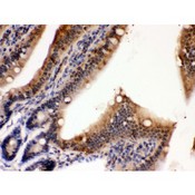 PDPK1 / PDK1 Antibody - PDPK1 antibody IHC-paraffin. IHC(P): Mouse Intestine Tissue.