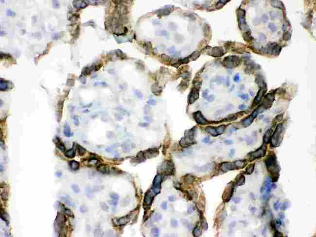 PDPK1 / PDK1 Antibody - IHC analysis of PDPK1 using anti-PDPK1 antibody. PDPK1 was detected in frozen section of human placenta tissue . Heat mediated antigen retrieval was performed in citrate buffer (pH6, epitope retrieval solution) for 20 mins. The tissue section was blocked with 10% goat serum. The tissue section was then incubated with 1µg/ml rabbit anti-PDPK1 Antibody overnight at 4°C. Biotinylated goat anti-rabbit IgG was used as secondary antibody and incubated for 30 minutes at 37°C. The tissue section was developed using Strepavidin-Biotin-Complex (SABC) with DAB as the chromogen.