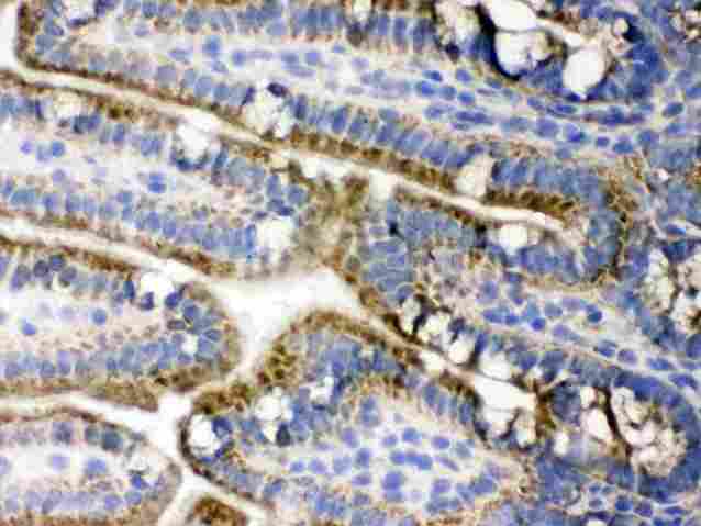 PDPK1 / PDK1 Antibody - IHC analysis of PDPK1 using anti-PDPK1 antibody. PDPK1 was detected in frozen section of mouse small intestine tissue. Heat mediated antigen retrieval was performed in citrate buffer (pH6, epitope retrieval solution) for 20 mins. The tissue section was blocked with 10% goat serum. The tissue section was then incubated with 1µg/ml rabbit anti-PDPK1 Antibody overnight at 4°C. Biotinylated goat anti-rabbit IgG was used as secondary antibody and incubated for 30 minutes at 37°C. The tissue section was developed using Strepavidin-Biotin-Complex (SABC) with DAB as the chromogen.