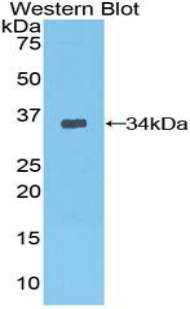 PDPK1 / PDK1 Antibody - Western blot of recombinant PDK1 / PDPK1.  This image was taken for the unconjugated form of this product. Other forms have not been tested.