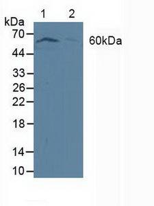 PDPK1 / PDK1 Antibody - Western Blot; Sample: Lane1: Human MCF-7 Cells; Lane2: Human Jurkat Cells.