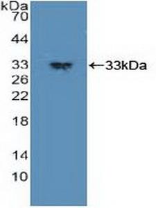 PDPK1 / PDK1 Antibody - Western Blot; Sample: Recombinant PDPK1, Human.