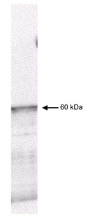 PDPK1 / PDK1 Antibody - Western blot of affinity purified anti-PKD-1 antibody shows detection of myc-tagged human PDK-1 at 60kD in ~10 ug of a virus infected Sf9 cell lysate (arrow). The nitrocellulose membrane was probed overnight at 4 degrees C with the primary antibody diluted 1:750 in 1% non-fat dry milk. HRP conjugated Goat-anti-Rabbit IgG and chemiluminescent detection is recommended. Other detection systems will yield similar results.