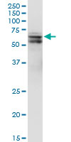 PDPK1 / PDK1 Antibody - PDPK1 monoclonal antibody (M05), clone 2E2. Western Blot analysis of PDPK1 expression in IMR-32.