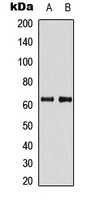 PDPK1 / PDK1 Antibody - Western blot analysis of PDPK1 expression in HeLa (A); PC12 (B) whole cell lysates.