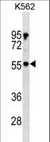 PDPK1 / PDK1 Antibody - PDPK1 Antibody western blot of K562 cell line lysates (35 ug/lane). The PDPK1 antibody detected the PDPK1 protein (arrow).